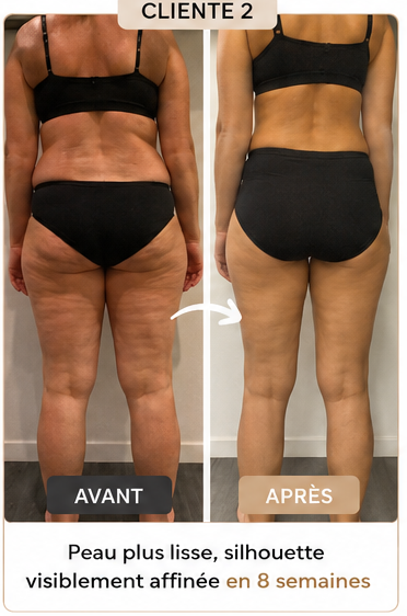 Cliente 2 avant-après : peau plus lisse, silhouette affinée en 8 semaines